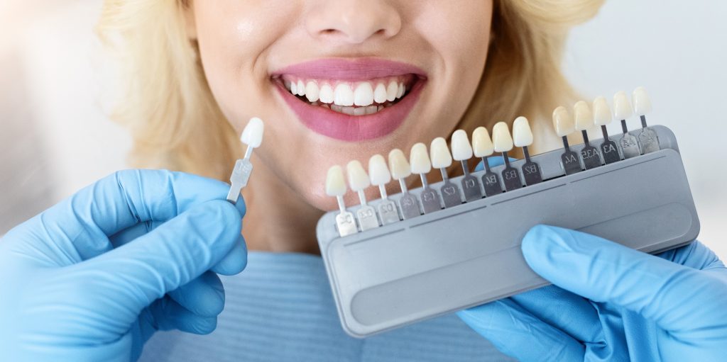 Dentist comparing porcelain veneer shades to a patient’s natural teeth